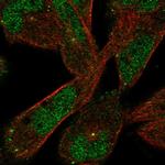 DAAM2 Polyclonal Antibody
