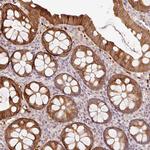 ZNF394 Antibody in Immunohistochemistry (Paraffin) (IHC (P))