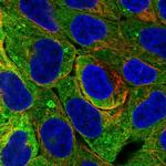 PLIN4 Polyclonal Antibody