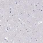 PLIN4 Antibody in Immunohistochemistry (Paraffin) (IHC (P))