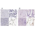 PLIN4 Antibody in Immunohistochemistry (IHC)