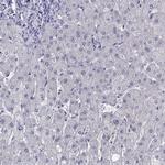PLIN4 Antibody in Immunohistochemistry (IHC)