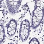 PLIN4 Antibody in Immunohistochemistry (IHC)