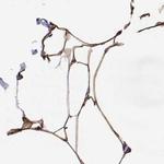 PLIN4 Antibody in Immunohistochemistry (IHC)