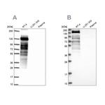 PLIN4 Antibody in Western Blot (WB)