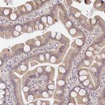 SLC35B3 Polyclonal Antibody