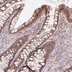 LYPD5 Antibody in Immunohistochemistry (Paraffin) (IHC (P))