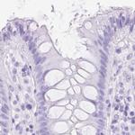 SLC8A2 Antibody in Immunohistochemistry (IHC)