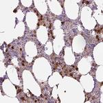 TDRD15 Antibody in Immunohistochemistry (Paraffin) (IHC (P))
