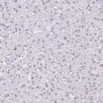 B3GALT5 Antibody in Immunohistochemistry (Paraffin) (IHC (P))