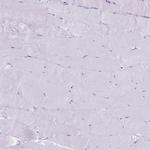 B3GALT5 Antibody in Immunohistochemistry (Paraffin) (IHC (P))