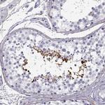 GTSF1L Antibody in Immunohistochemistry (IHC)