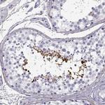 GTSF1L Polyclonal Antibody