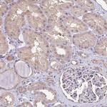 RBG1L Antibody in Immunohistochemistry (Paraffin) (IHC (P))