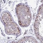 ZBTB25 Antibody in Immunohistochemistry (Paraffin) (IHC (P))