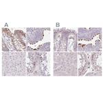 TMEM237 Antibody in Immunohistochemistry (IHC)