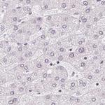 TMEM237 Antibody in Immunohistochemistry (IHC)