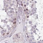 TMEM237 Antibody in Immunohistochemistry (IHC)
