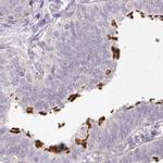 TMEM237 Antibody in Immunohistochemistry (IHC)