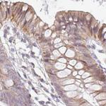 TMEM237 Antibody in Immunohistochemistry (IHC)