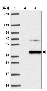 TMEM237 Antibody in Western Blot (WB)