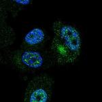 ZNF35 Polyclonal Antibody