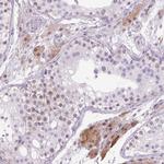 ZNF35 Antibody in Immunohistochemistry (IHC)