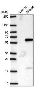ZNF35 Antibody in Western Blot (WB)