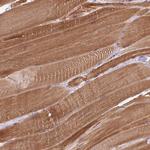 FAM65C Polyclonal Antibody