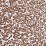 TTC39B Antibody in Immunohistochemistry (Paraffin) (IHC (P))