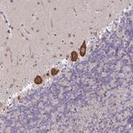LARP1 Antibody in Immunohistochemistry (Paraffin) (IHC (P))