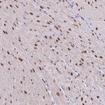 ABCA9 Antibody in Immunohistochemistry (Paraffin) (IHC (P))