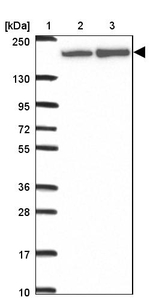 ABCA9 Antibody in Western Blot (WB)