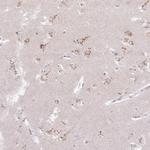 ABR Polyclonal Antibody