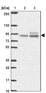 ABR Antibody in Western Blot (WB)