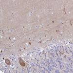 Carbonic Anhydrase X Antibody in Immunohistochemistry (Paraffin) (IHC (P))