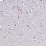 Carbonic Anhydrase X Antibody in Immunohistochemistry (Paraffin) (IHC (P))