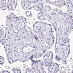 Carbonic Anhydrase X Antibody in Immunohistochemistry (Paraffin) (IHC (P))