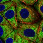 RPS23 Polyclonal Antibody