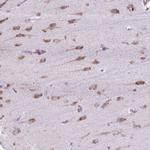 RPS23 Antibody in Immunohistochemistry (Paraffin) (IHC (P))