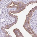 RPS23 Antibody in Immunohistochemistry (Paraffin) (IHC (P))
