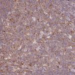 RPS23 Antibody in Immunohistochemistry (Paraffin) (IHC (P))