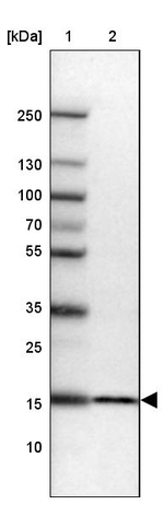 RPS23 Antibody in Western Blot (WB)