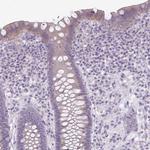 NHSL2 Polyclonal Antibody