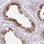 CXorf22 Polyclonal Antibody