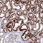 DZIP1 Polyclonal Antibody