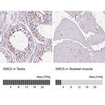 SMC5 Antibody
