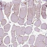 TRIM72 Polyclonal Antibody