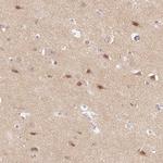 DNAJC6 Antibody in Immunohistochemistry (Paraffin) (IHC (P))