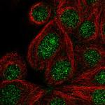 DENND2C Polyclonal Antibody